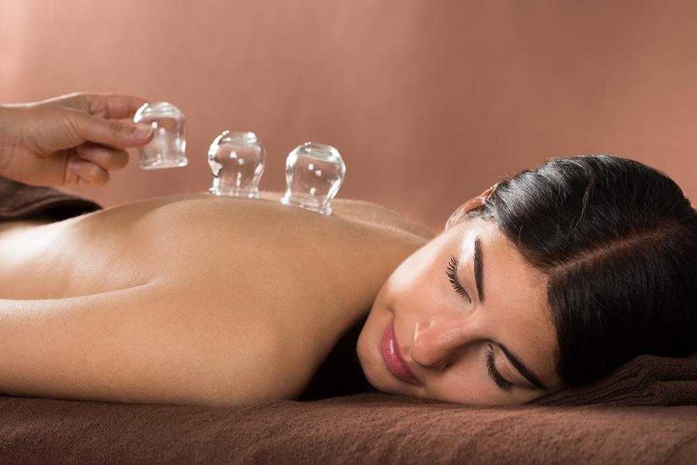 Cupping Therapy at Lake View Chiropractic